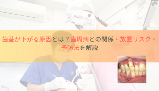 歯茎が下がる原因とは？歯周病との関係・放置リスク・予防法を解説
