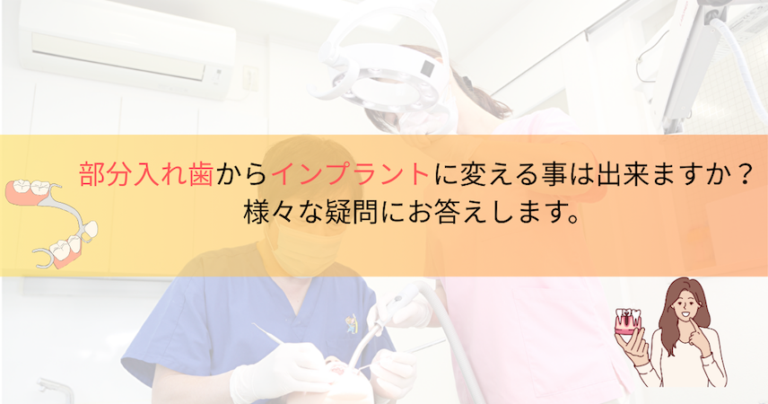 部分入れ歯からインプラントに変える事は出来ますか？様々な疑問にお答えしますのサムネイル画像