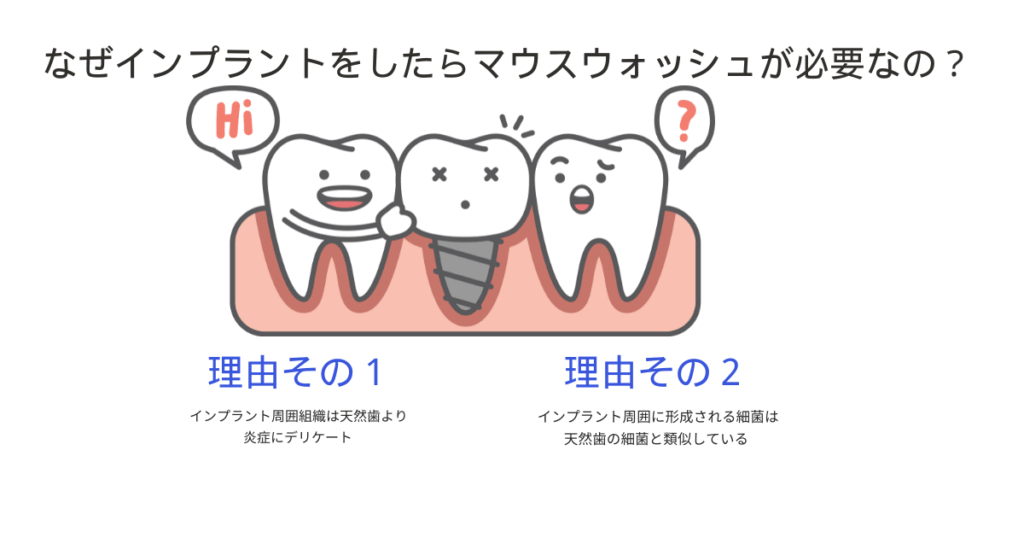 なぜインプラントをしたらマウスウォッシュが必要なの？のサムネ