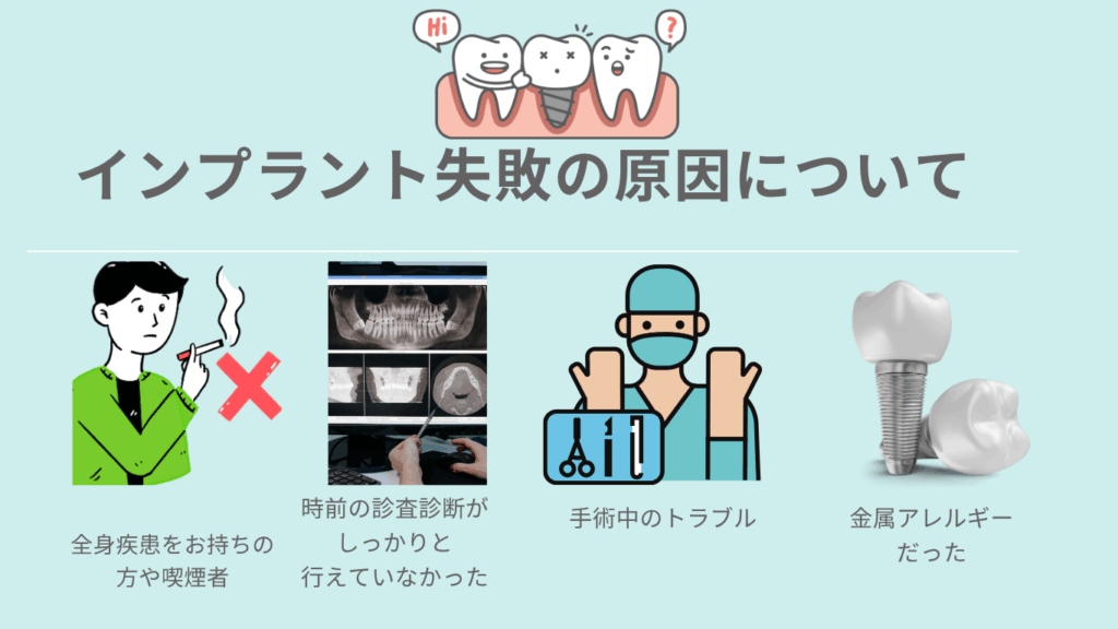 インプラント失敗の原因についてのサムネ