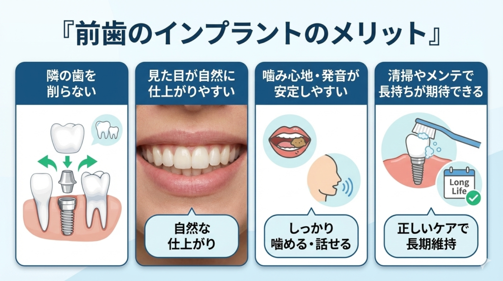 前歯のインプラントのメリットのサムネイル画像