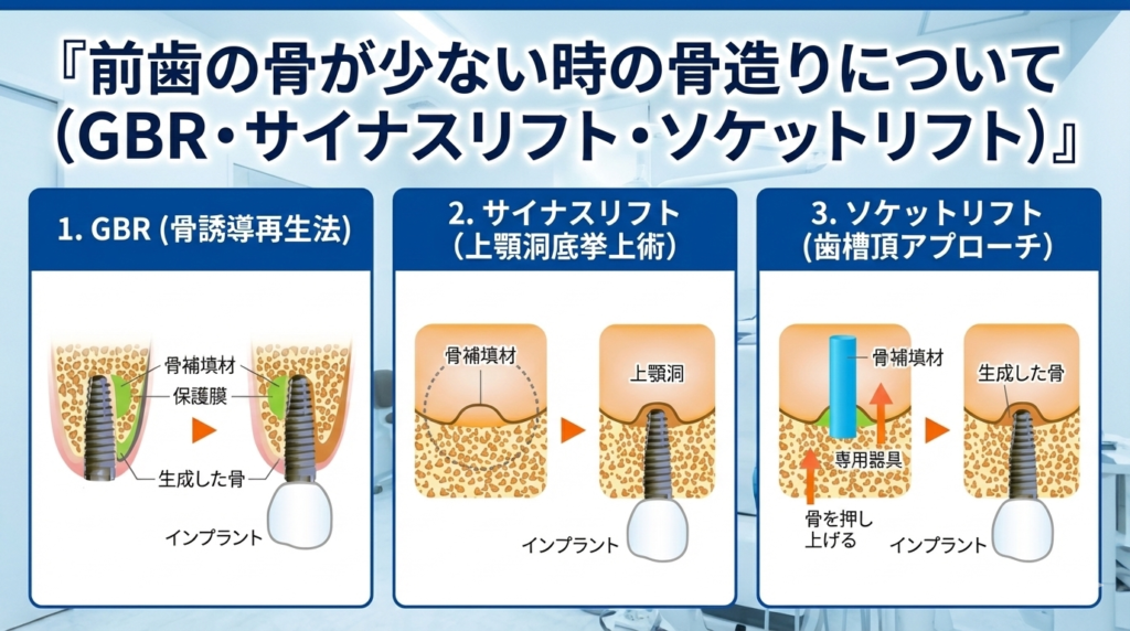骨が少ない時の骨造りについて（GBR・サイナスリフト・ソケットリフト）のサムネイル画像