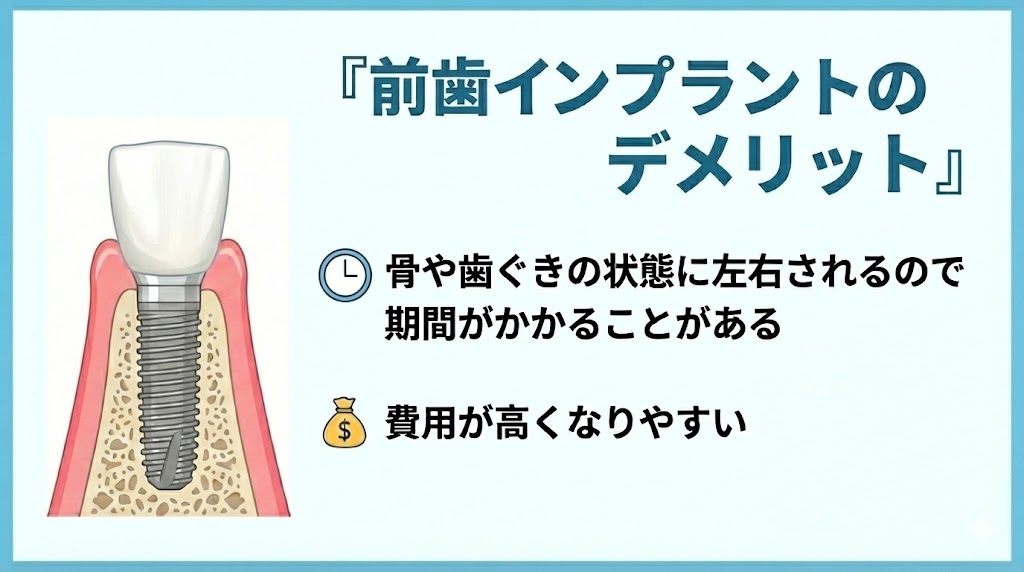 前歯インプラントのデメリットのサムネイル画像