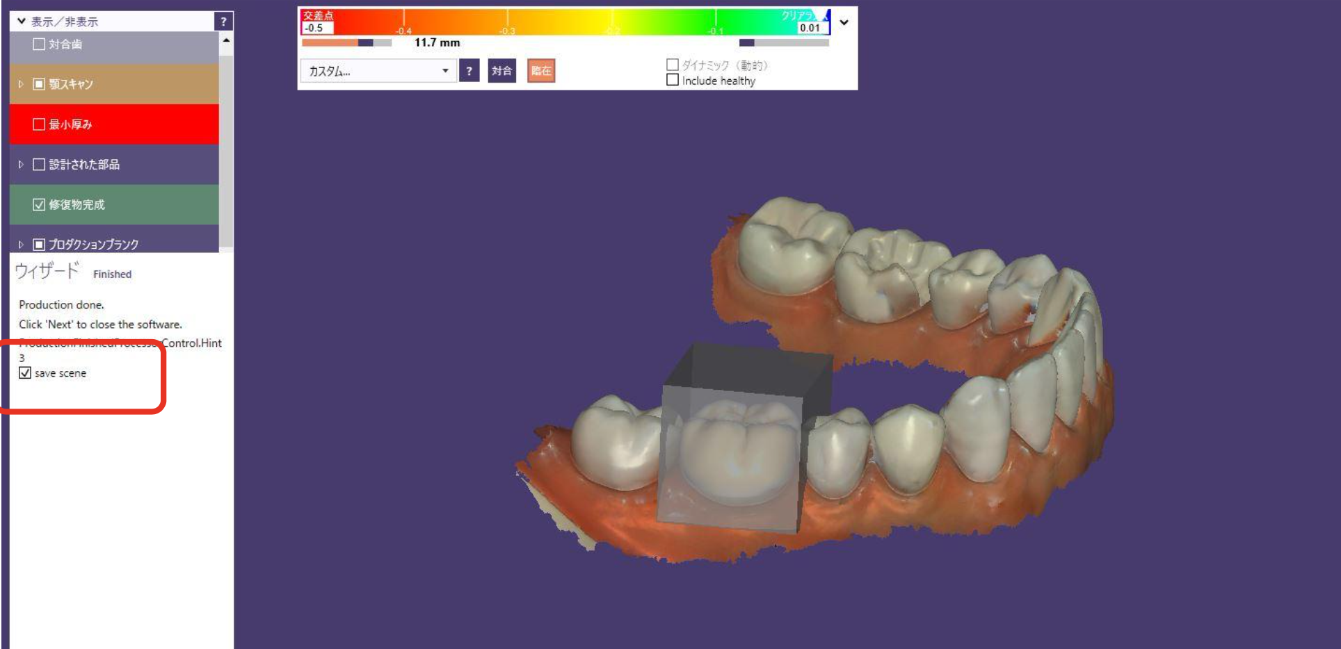 CAD/CAM（キャドカム）冠について « 稲毛区の歯医者｜かずなか歯科クリニック｜夜19時最終受付